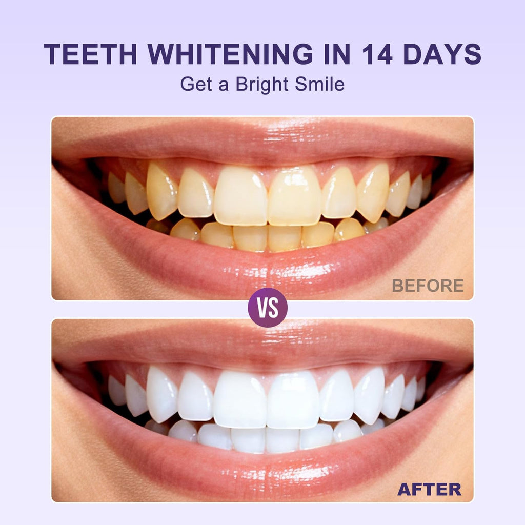 WhiteSmile Teeth Whitening Strips (14 Strips)