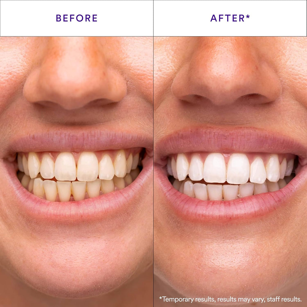 WhiteSmile Teeth Whitening Strips (14 Strips)