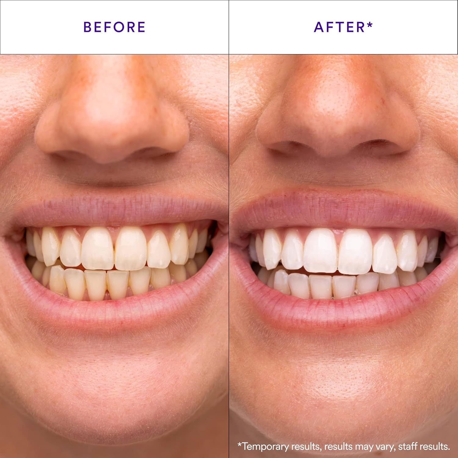 WhiteSmile Teeth Whitening Strips (14 Strips)